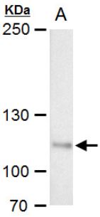 Western blot - Anti-OGT / O-Linked N-Acetylglucosamine Transferase antibody (ab96718), expandable thumbnail