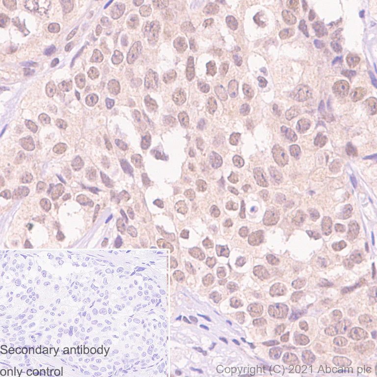 Immunohistochemistry (Formalin/PFA-fixed paraffin-embedded sections) - Anti-OGT / O-Linked N-Acetylglucosamine Transferase antibody [EPR12713] (AB177941)