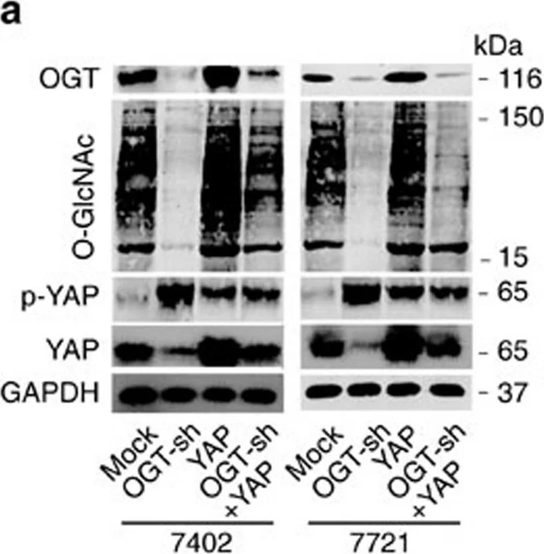 Western blot - Anti-OGT / O-Linked N-Acetylglucosamine Transferase antibody [EPR12713] (AB177941)