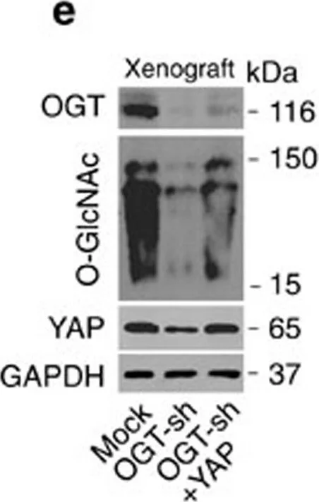 Western blot - Anti-OGT / O-Linked N-Acetylglucosamine Transferase antibody [EPR12713] (AB177941)