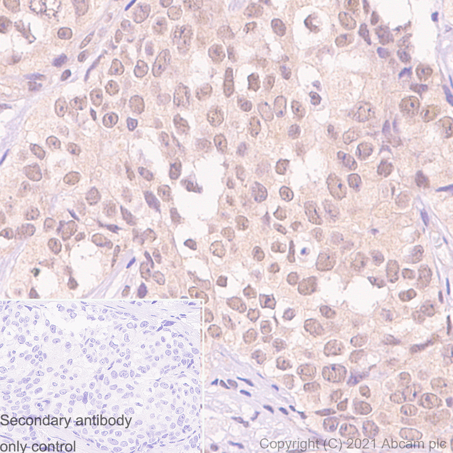 Immunohistochemistry (Formalin/PFA-fixed paraffin-embedded sections) - Anti-OGT / O-Linked N-Acetylglucosamine Transferase antibody [EPR12713] - BSA and Azide free (AB236014)