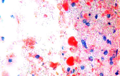Histology - Oil Red O Stain Kit (Lipid Stain) (AB150678)