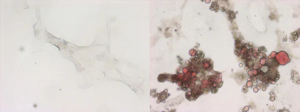 Histology - Oil Red O Stain Kit (Lipid Stain) (AB150678)
