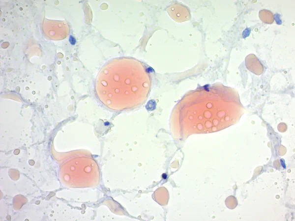Histology - Oil Red O Stain Kit (Lipid Stain) (AB150678)