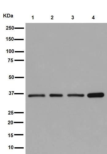 Western blot - Anti-OLF1 antibody [EPR15972] (AB190792)