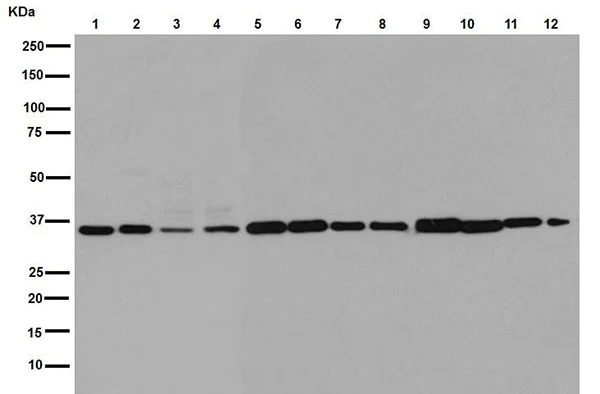 Western blot - Anti-OLF1 antibody [EPR15972] - BSA and Azide free (AB251035)