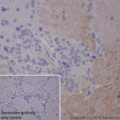 Immunohistochemistry (Formalin/PFA-fixed paraffin-embedded sections) - Anti-Olfactory Marker Protein/OMP antibody [EPR19157] (AB183948)