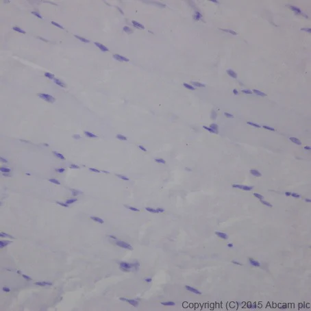 Immunohistochemistry (Formalin/PFA-fixed paraffin-embedded sections) - Anti-Olfactory Marker Protein/OMP antibody [EPR19157] (AB183948)