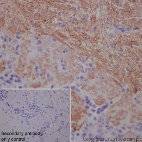 Immunohistochemistry (Formalin/PFA-fixed paraffin-embedded sections) - Anti-Olfactory Marker Protein/OMP antibody [EPR19157] (AB183948)