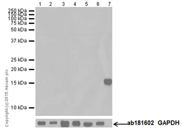 Western blot - Anti-Olfactory Marker Protein/OMP antibody [EPR19157] (AB183948)