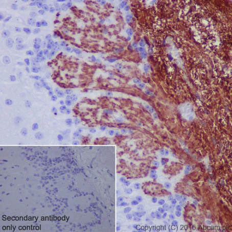Immunohistochemistry (Formalin/PFA-fixed paraffin-embedded sections) - Anti-Olfactory Marker Protein/OMP antibody [EPR19190] (AB183947)