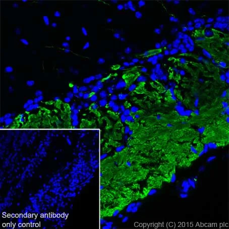 Immunohistochemistry (Frozen sections) - Anti-Olfactory Marker Protein/OMP antibody [EPR19190] (AB183947)