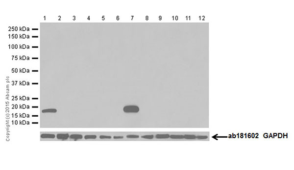 Western blot - Anti-Olfactory Marker Protein/OMP antibody [EPR19190] (AB183947)