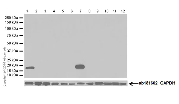 Western blot - Anti-Olfactory Marker Protein/OMP antibody [EPR19190] (AB183947)