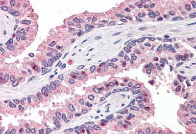 Immunohistochemistry (Formalin/PFA-fixed paraffin-embedded sections) - Anti-OLFM4 antibody (AB188822), expandable thumbnail