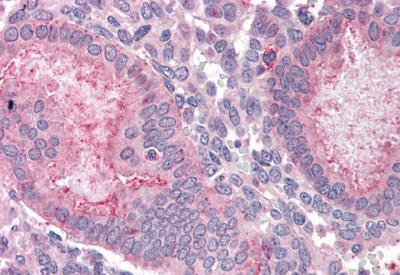 Immunohistochemistry (Formalin/PFA-fixed paraffin-embedded sections) - Anti-OLFM4 antibody (AB188822), expandable thumbnail