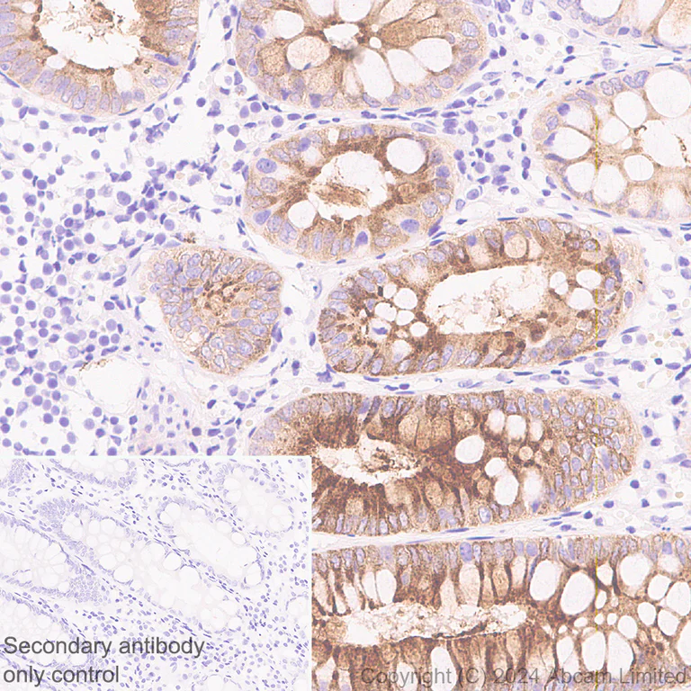 Immunohistochemistry (Formalin/PFA-fixed paraffin-embedded sections) - Anti-OLFM4 antibody [EPR29030-1] (AB322350)