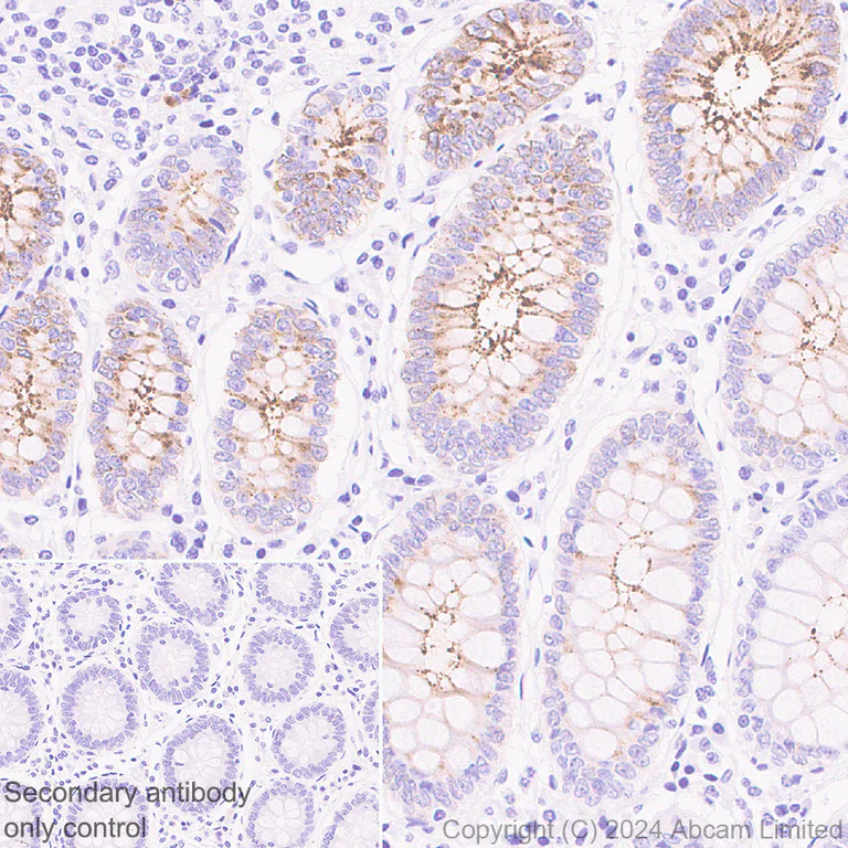 Immunohistochemistry (Formalin/PFA-fixed paraffin-embedded sections) - Anti-OLFM4 antibody [EPR29030-1] (AB322350)