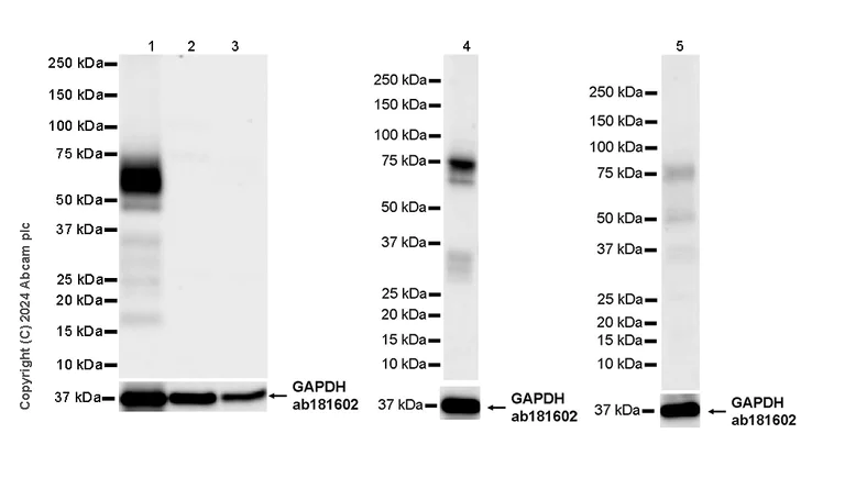 Western blot - Anti-OLFM4 antibody [EPR29030-1] (AB322350)