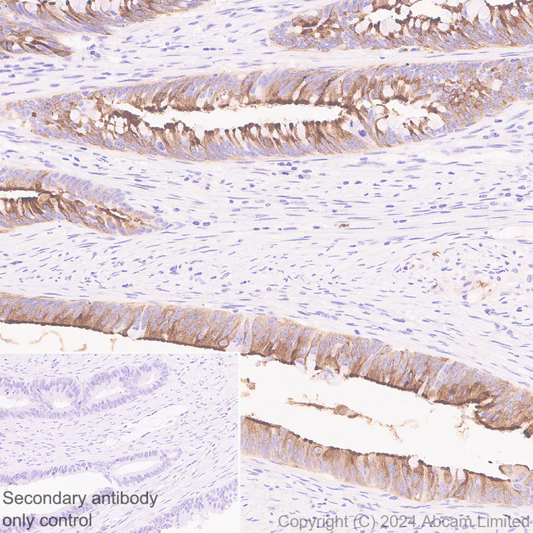 Immunohistochemistry (Formalin/PFA-fixed paraffin-embedded sections) - Anti-OLFM4 antibody [EPR29030-1] - BSA and Azide free (AB324791)