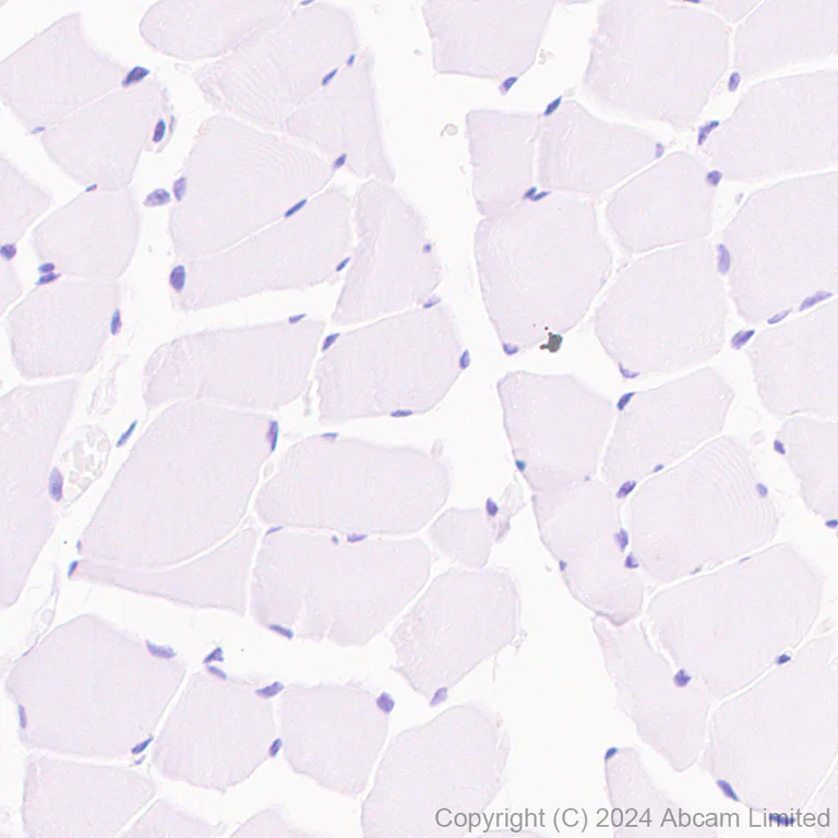 Immunohistochemistry (Formalin/PFA-fixed paraffin-embedded sections) - Anti-OLFM4 antibody [EPR29030-1] - BSA and Azide free (AB324791)