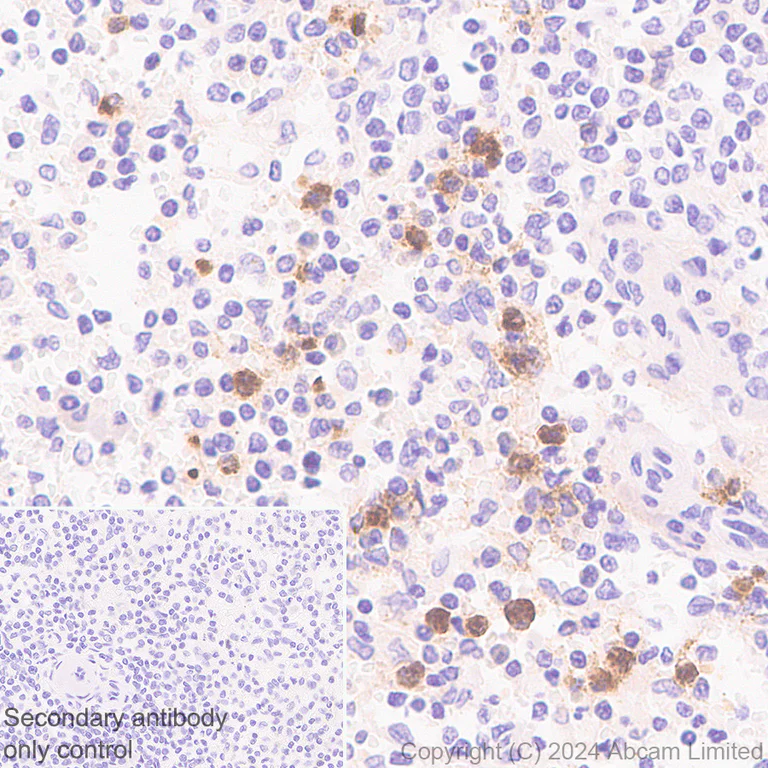 Immunohistochemistry (Formalin/PFA-fixed paraffin-embedded sections) - Anti-OLFM4 antibody [EPR29030-1] - BSA and Azide free (AB324791)