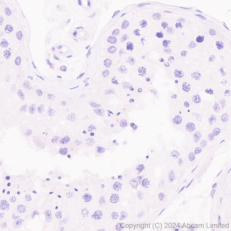 Immunohistochemistry (Formalin/PFA-fixed paraffin-embedded sections) - Anti-OLFM4 antibody [EPR29030-1] - BSA and Azide free (AB324791)