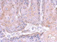 Immunohistochemistry (Formalin/PFA-fixed paraffin-embedded sections) - Anti-OLFML3 antibody (AB111712), expandable thumbnail