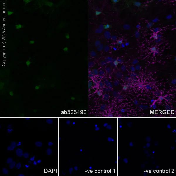 Immunocytochemistry/ Immunofluorescence - Anti-Olig1 antibody [EPR30098-92] (AB325492)