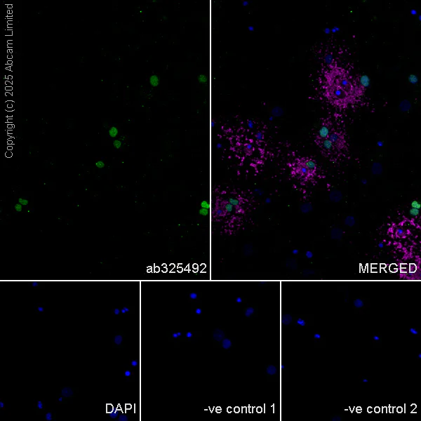 Immunocytochemistry/ Immunofluorescence - Anti-Olig1 antibody [EPR30098-92] (AB325492)