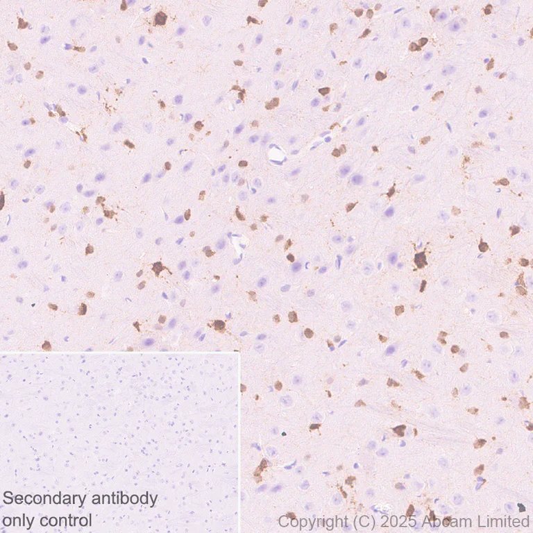 Immunohistochemistry (Formalin/PFA-fixed paraffin-embedded sections) - Anti-Olig1 antibody [EPR30098-92] (AB325492)