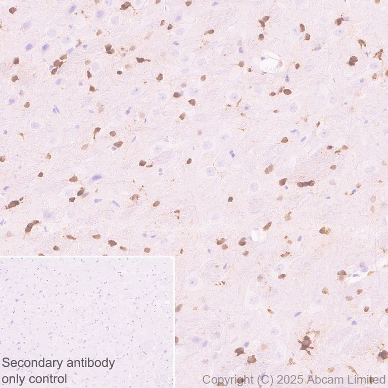Immunohistochemistry (Formalin/PFA-fixed paraffin-embedded sections) - Anti-Olig1 antibody [EPR30098-92] (AB325492)