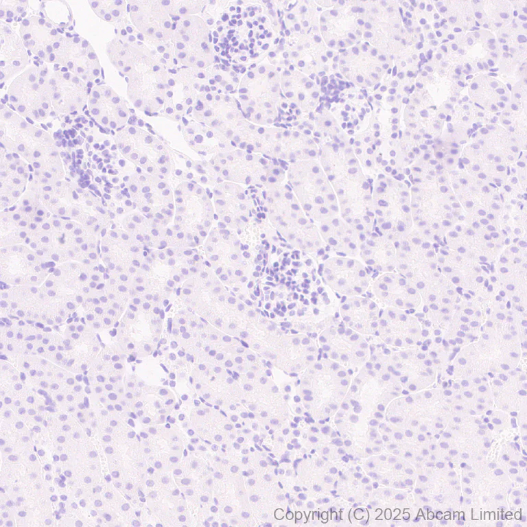 Immunohistochemistry (Formalin/PFA-fixed paraffin-embedded sections) - Anti-Olig1 antibody [EPR30098-92] (AB325492)