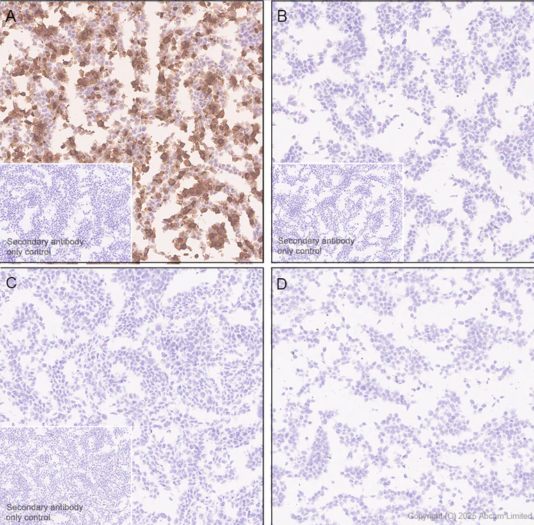Immunohistochemistry (Formalin/PFA-fixed paraffin-embedded sections) - Anti-Olig1 antibody [EPR30098-92] (AB325492)
