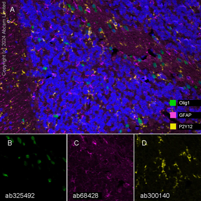 Multiplex immunohistochemistry - Anti-Olig1 antibody [EPR30098-92] (AB325492)