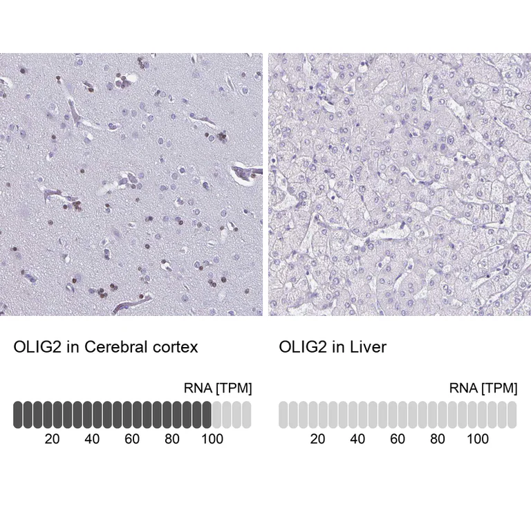 Immunohistochemistry (Formalin/PFA-fixed paraffin-embedded sections) - Anti-OLIG2 Antibody (AB327177)