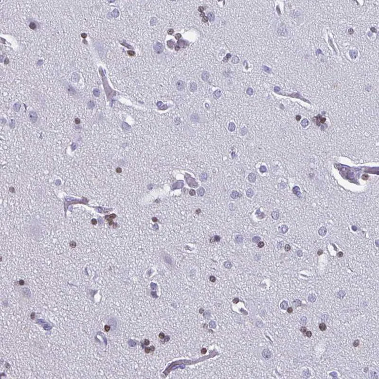 Immunohistochemistry (Formalin/PFA-fixed paraffin-embedded sections) - Anti-OLIG2 Antibody (AB327177)
