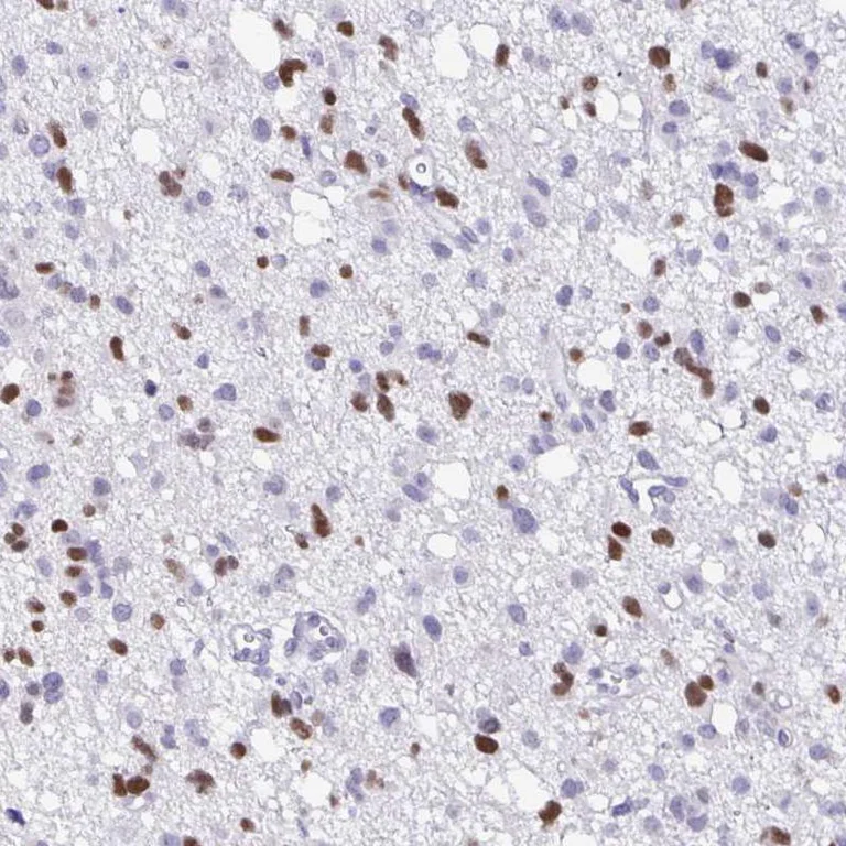 Immunohistochemistry (Formalin/PFA-fixed paraffin-embedded sections) - Anti-OLIG2 Antibody (AB327177)
