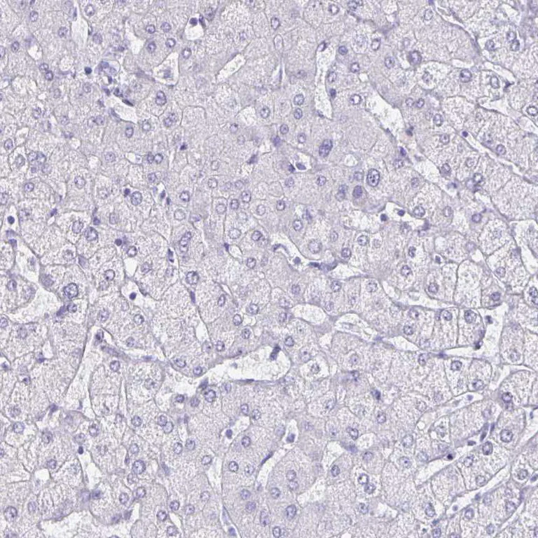Immunohistochemistry (Formalin/PFA-fixed paraffin-embedded sections) - Anti-OLIG2 Antibody (AB327177)