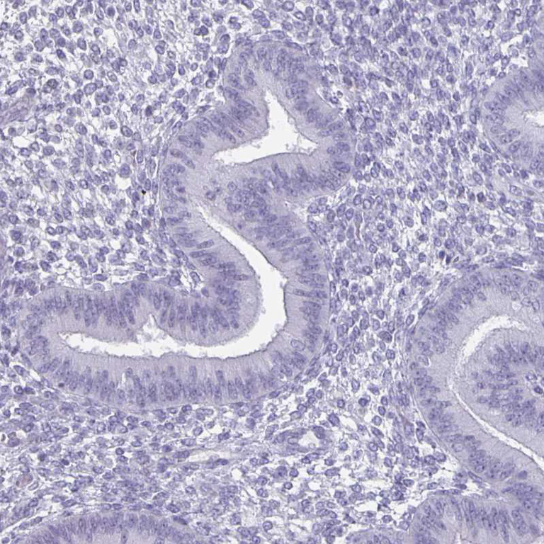 Immunohistochemistry (Formalin/PFA-fixed paraffin-embedded sections) - Anti-OLIG2 Antibody (AB327177)
