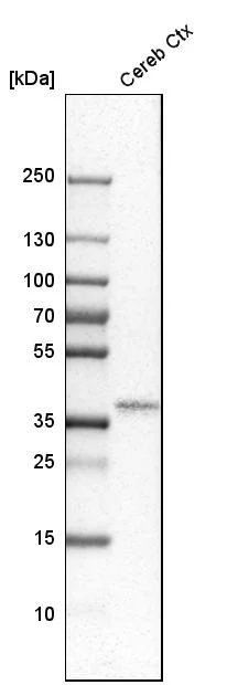 Western blot - Anti-OLIG2 Antibody (AB327177)