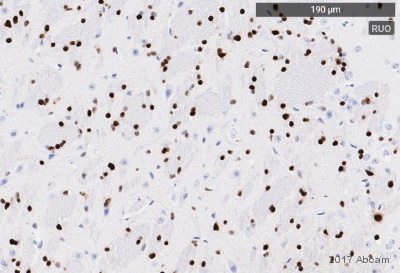 Immunohistochemistry (Formalin/PFA-fixed paraffin-embedded sections) - Anti-Olig2 antibody [EPR2673] (ab109186), expandable thumbnail
