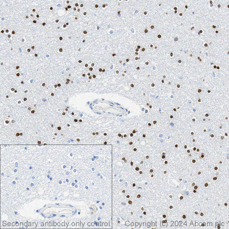 Immunohistochemistry (Formalin/PFA-fixed paraffin-embedded sections) - Anti-Olig2 antibody [EPR2673] (ab109186), expandable thumbnail
