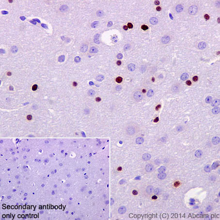 Immunohistochemistry (Formalin/PFA-fixed paraffin-embedded sections) - Anti-Olig2 antibody [EPR2673] (ab109186), expandable thumbnail