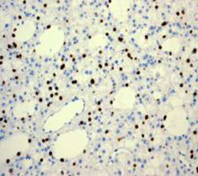 Immunohistochemistry (Formalin/PFA-fixed paraffin-embedded sections) - Anti-Olig2 antibody [EPR2673] (ab109186), expandable thumbnail