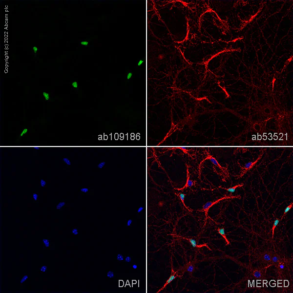 Immunocytochemistry/ Immunofluorescence - Anti-Olig2 antibody [EPR2673] - BSA and Azide free (AB220796)
