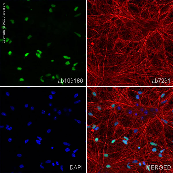 Immunocytochemistry/ Immunofluorescence - Anti-Olig2 antibody [EPR2673] - BSA and Azide free (AB220796)