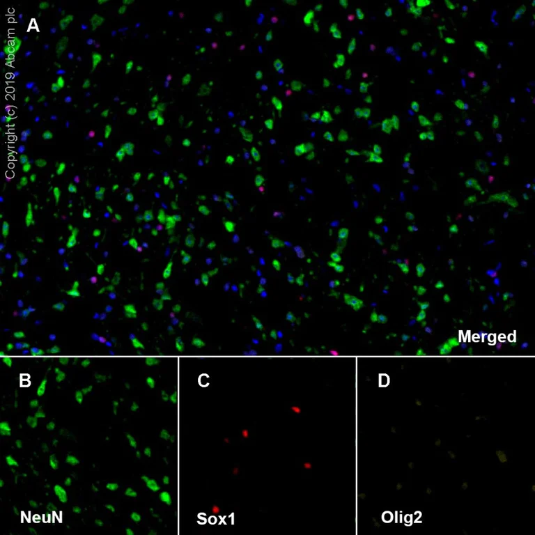 Immunohistochemistry (Formalin/PFA-fixed paraffin-embedded sections) - Anti-Olig2 antibody [EPR2673] - Oligodendrocyte Marker (AB109186)