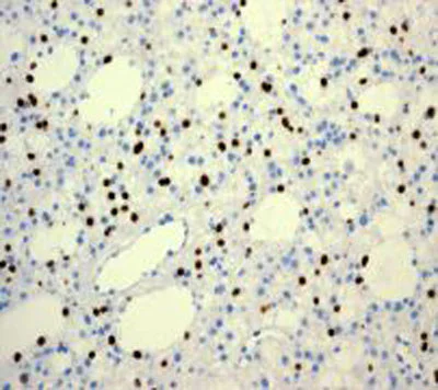 Immunohistochemistry (Formalin/PFA-fixed paraffin-embedded sections) - Anti-Olig2 antibody [EPR2673] - Oligodendrocyte Marker (AB109186)
