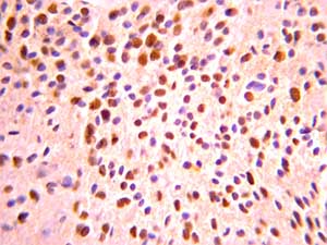 Immunohistochemistry (Formalin/PFA-fixed paraffin-embedded sections) - Anti-Olig2 antibody - Oligodendrocyte Marker (AB136253)